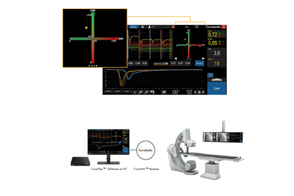 Abbott lança no Brasil a plataforma CoroFlow‡